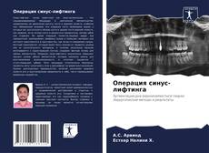 Couverture de Операция синус-лифтинга