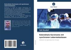 Обложка Kolorektale Karzinome mit synchronen Lebermetastasen