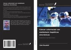 Borítókép a  Cáncer colorrectal con metástasis hepáticas sincrónicas - hoz
