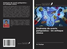 Buchcover von Síndrome de ovario poliquístico - Un enfoque clínico