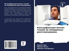 Capa do livro de Kальцификация мягких тканей на панорамных рентгенограммах 