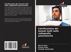 Bookcover of Calcificazione dei tessuti molli nelle radiografie panoramiche