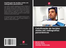 Couverture de Calcificação de tecidos moles em radiografias panorâmicas