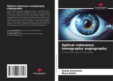 Bookcover of Optical coherence tomography angiography