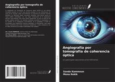 Обложка Angiografía por tomografía de coherencia óptica
