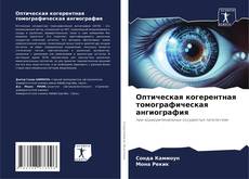 Couverture de Оптическая когерентная томографическая ангиография