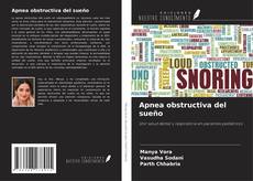 Couverture de Apnea obstructiva del sueño