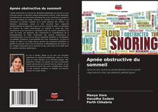 Bookcover of Apnée obstructive du sommeil