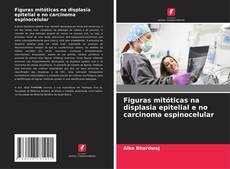 Couverture de Figuras mitóticas na displasia epitelial e no carcinoma espinocelular