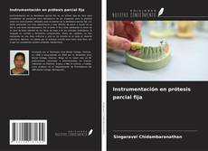 Instrumentación en prótesis parcial fija kitap kapağı