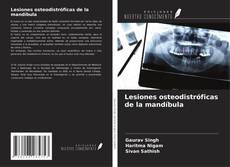 Portada del libro de Lesiones osteodistróficas de la mandíbula