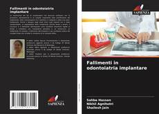 Bookcover of Fallimenti in odontoiatria implantare