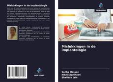 Portada del libro de Mislukkingen in de implantologie