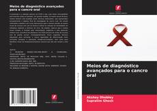 Couverture de Meios de diagnóstico avançados para o cancro oral