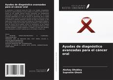 Borítókép a  Ayudas de diagnóstico avanzadas para el cáncer oral - hoz