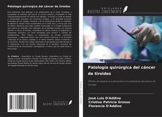 Patología quirúrgica del cáncer de tiroides kitap kapağı