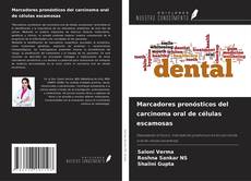 Borítókép a  Marcadores pronósticos del carcinoma oral de células escamosas - hoz