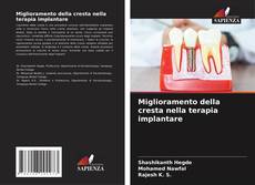 Bookcover of Miglioramento della cresta nella terapia implantare