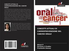 Bookcover of CONCETTI ATTUALI DI CHEMIOPREVENZIONE DEL CANCRO ORALE