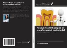 Portada del libro de Respuesta del huésped en la enfermedad periodontal