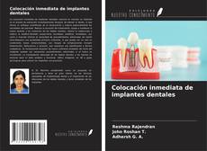 Portada del libro de Colocación inmediata de implantes dentales