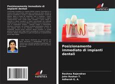 Bookcover of Posizionamento immediato di impianti dentali