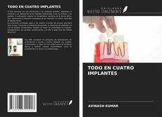 Bookcover of TODO EN CUATRO IMPLANTES