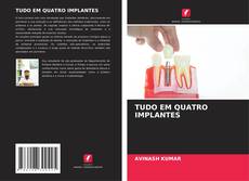 Portada del libro de TUDO EM QUATRO IMPLANTES