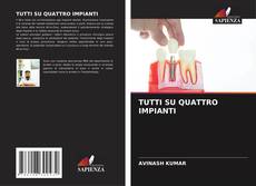 Portada del libro de TUTTI SU QUATTRO IMPIANTI