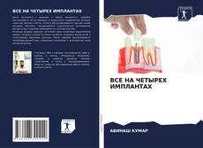 Capa do livro de ВСЕ НА ЧЕТЫРЕХ ИМПЛАНТАХ 