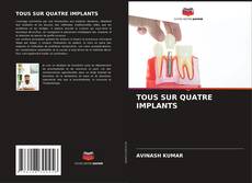 Couverture de TOUS SUR QUATRE IMPLANTS