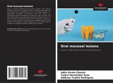 Copertina di Oral mucosal lesions