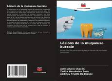 Buchcover von Lésions de la muqueuse buccale