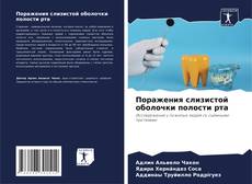 Capa do livro de Поражения слизистой оболочки полости рта 