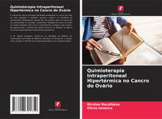 Couverture de Quimioterapia Intraperitoneal Hipertérmica no Cancro do Ovário