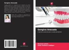 Portada del libro de Gengiva Anexada