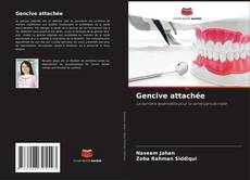 Couverture de Gencive attachée