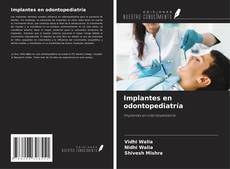 Couverture de Implantes en odontopediatría