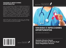 Copertina di VIH/SIDA E INFECCIONES OPORTUNISTAS