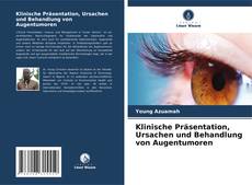 Bookcover of Klinische Präsentation, Ursachen und Behandlung von Augentumoren