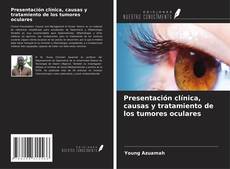 Portada del libro de Presentación clínica, causas y tratamiento de los tumores oculares