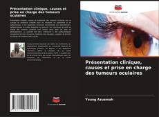 Couverture de Présentation clinique, causes et prise en charge des tumeurs oculaires