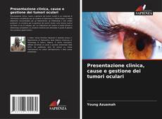 Bookcover of Presentazione clinica, cause e gestione dei tumori oculari