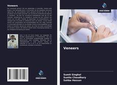 Bookcover of Veneers