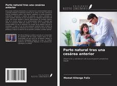 Bookcover of Parto natural tras una cesárea anterior