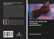 Bookcover of Fattori di rischio del carcinoma epatocellulare