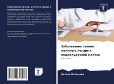 Bookcover of Заболевания печени, желчного пузыря и поджелудочной железы