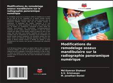Modifications du remodelage osseux mandibulaire sur la radiographie panoramique numérique的封面