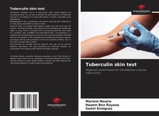 Tuberculin skin test kitap kapağı