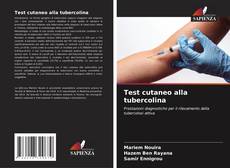 Couverture de Test cutaneo alla tubercolina